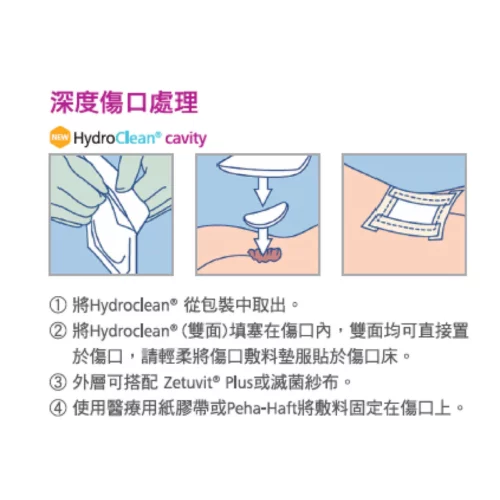 Alternative view of 德國 Hartmann HydroClean Cavity 水活性傷口敷料 (雙面填塞型)【3個尺寸】