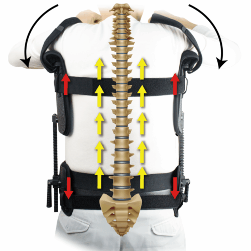 Alternative view of Medex B18B 腋下槓桿牽引器
