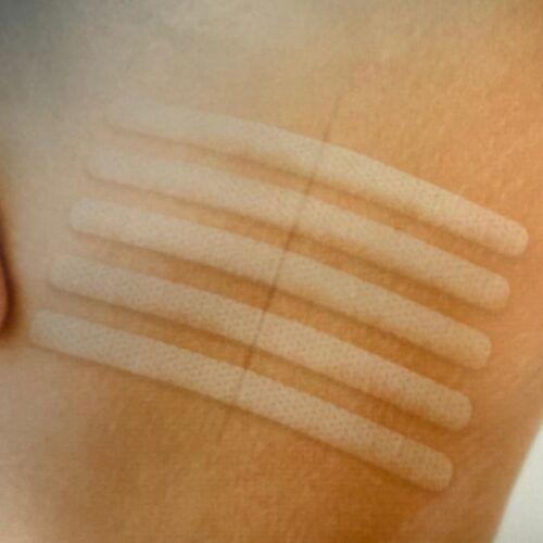 Alternative view of 意大利 Eurosuture 無菌不織布免縫膠帶 - 6 x 7.5cm (盒裝：50片，每片有3條) [DE25]【意大利製造】